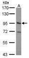 Integrin Subunit Beta 5 antibody, NBP2-16976, Novus Biologicals, Western Blot image 