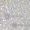 Phosphatidylinositol-4-Phosphate 3-Kinase Catalytic Subunit Type 2 Alpha antibody, A8526, ABclonal Technology, Immunohistochemistry paraffin image 