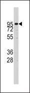 ADAM Metallopeptidase Domain 17 antibody, PA5-11572, Invitrogen Antibodies, Western Blot image 