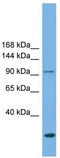Exocyst Complex Component 1 antibody, TA344612, Origene, Western Blot image 