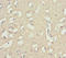 Inositol Polyphosphate-4-Phosphatase Type I A antibody, LS-C675903, Lifespan Biosciences, Immunohistochemistry paraffin image 