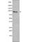 FES Proto-Oncogene, Tyrosine Kinase antibody, abx215329, Abbexa, Western Blot image 