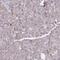 Prolyl Endopeptidase antibody, PA5-56725, Invitrogen Antibodies, Immunohistochemistry frozen image 