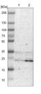 Transmembrane P24 Trafficking Protein 9 antibody, NBP1-83193, Novus Biologicals, Western Blot image 