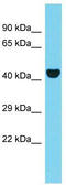 Protein AAR2 homolog antibody, TA331950, Origene, Western Blot image 