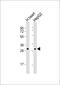 Holocytochrome C Synthase antibody, 64-165, ProSci, Western Blot image 
