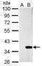 Galectin 4 antibody, PA5-34913, Invitrogen Antibodies, Western Blot image 