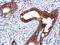 Plakophilin 1 antibody, NBP2-19857, Novus Biologicals, Immunohistochemistry paraffin image 
