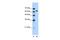 SPT16 Homolog, Facilitates Chromatin Remodeling Subunit antibody, PA5-40388, Invitrogen Antibodies, Western Blot image 