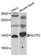 Nuclear Transport Factor 2 antibody, LS-C335707, Lifespan Biosciences, Western Blot image 
