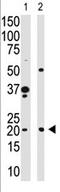 Hippocalcin antibody, AP11595PU-N, Origene, Western Blot image 