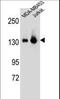 Splicing Factor 3b Subunit 3 antibody, LS-C169008, Lifespan Biosciences, Western Blot image 