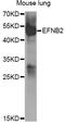 Ephrin B2 antibody, STJ27636, St John