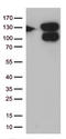 VPS50 Subunit Of EARP/GARPII Complex antibody, LS-C796225, Lifespan Biosciences, Western Blot image 