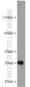 GDNF Family Receptor Alpha 2 antibody, 21973-1-AP, Proteintech Group, Western Blot image 