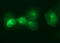 CD126 antibody, M01425, Boster Biological Technology, Immunofluorescence image 