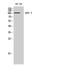 Diacylglycerol Kinase Theta antibody, A08705, Boster Biological Technology, Western Blot image 