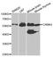 Calcium/Calmodulin Dependent Protein Kinase IV antibody, A5304, ABclonal Technology, Western Blot image 