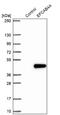 Calcium Release Activated Channel Regulator 2B antibody, NBP1-91863, Novus Biologicals, Western Blot image 