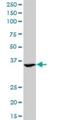 Asialoglycoprotein Receptor 2 antibody, H00000433-M05, Novus Biologicals, Western Blot image 