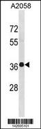 TruB Pseudouridine Synthase Family Member 2 antibody, 60-948, ProSci, Western Blot image 