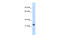 ETS Homologous Factor antibody, 29-195, ProSci, Enzyme Linked Immunosorbent Assay image 