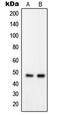 G Protein Regulated Inducer Of Neurite Outgrowth 2 antibody, LS-C353187, Lifespan Biosciences, Western Blot image 