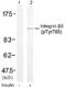 Integrin Subunit Beta 3 antibody, NB100-81995, Novus Biologicals, Western Blot image 