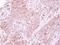 Lactate Dehydrogenase A antibody, NBP2-19320, Novus Biologicals, Immunohistochemistry paraffin image 