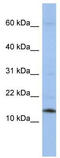 Small Nuclear Ribonucleoprotein D2 Polypeptide antibody, TA345887, Origene, Western Blot image 