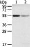 Solute Carrier Family 17 Member 1 antibody, PA5-50829, Invitrogen Antibodies, Western Blot image 