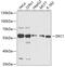 Dyskerin Pseudouridine Synthase 1 antibody, 14-697, ProSci, Western Blot image 