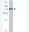 Armadillo Repeat Containing 1 antibody, H00055156-M01, Novus Biologicals, Western Blot image 