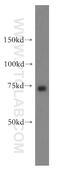 Mitochondrial TRNA Translation Optimization 1 antibody, 15650-1-AP, Proteintech Group, Western Blot image 