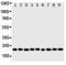 Cytoglobin antibody, PA1657, Boster Biological Technology, Western Blot image 