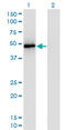 TNF Receptor Associated Factor 2 antibody, LS-C198366, Lifespan Biosciences, Western Blot image 