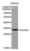 Homeobox A9 antibody, abx001561, Abbexa, Western Blot image 