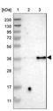 Purinergic Receptor P2Y12 antibody, NBP2-33870, Novus Biologicals, Western Blot image 