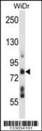 Transmembrane And Tetratricopeptide Repeat Containing 4 antibody, 57-296, ProSci, Western Blot image 