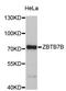 Zinc finger and BTB domain-containing protein 7B antibody, STJ26148, St John