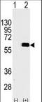 AKT Serine/Threonine Kinase 2 antibody, LS-C98942, Lifespan Biosciences, Western Blot image 
