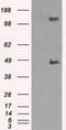 Lysyl Oxidase antibody, LS-C114933, Lifespan Biosciences, Western Blot image 