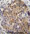 Suppression Of Tumorigenicity 14 antibody, abx032753, Abbexa, Immunohistochemistry paraffin image 