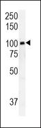 RAS Guanyl Releasing Protein 1 antibody, PA5-25750, Invitrogen Antibodies, Western Blot image 