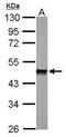 Protein Phosphatase, Mg2+/Mn2+ Dependent 1A antibody, GTX111288, GeneTex, Western Blot image 