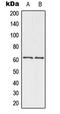 Checkpoint Kinase 2 antibody, LS-C353854, Lifespan Biosciences, Western Blot image 