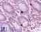 Eukaryotic Translation Elongation Factor 2 antibody, LS-B4686, Lifespan Biosciences, Immunohistochemistry frozen image 