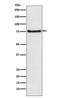 Bradykinin Receptor B2 antibody, M03117, Boster Biological Technology, Western Blot image 