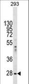 Eukaryotic Translation Initiation Factor 2B Subunit Alpha antibody, LS-C167679, Lifespan Biosciences, Western Blot image 