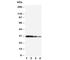Kallikrein 1 antibody, R30798, NSJ Bioreagents, Western Blot image 